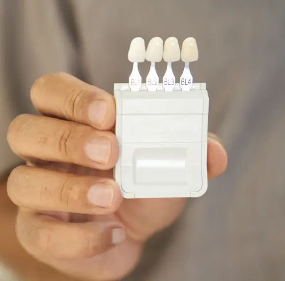 Hand holding dental veneer shade guide showing four tooth-colored veneer options for smile enhancement.